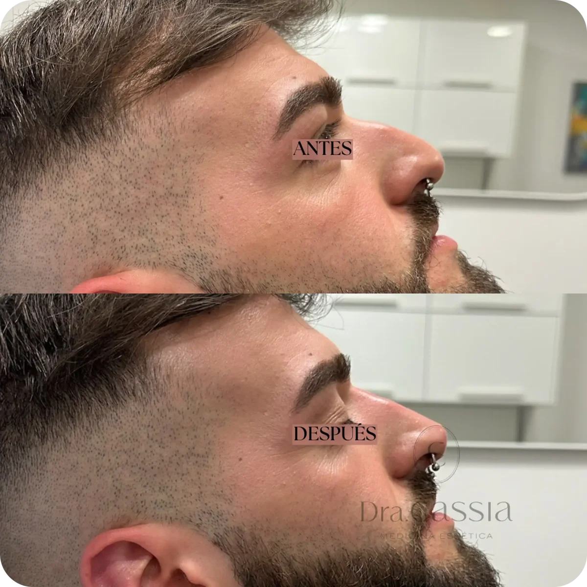 Dra. Cassia Castillo, Medicina Estética, Armonía, Salud, Autentecidad, Madrid, Avenida Felipe, España, Tratamiento Superior, Tratamiento Medio, Tratemiento Inferior, Tratamientos Corporales, Tratamiento Capilar, Tratamiento Corporales, especialista en embellecimiento y rejuvenecimiento facial. Olistic,