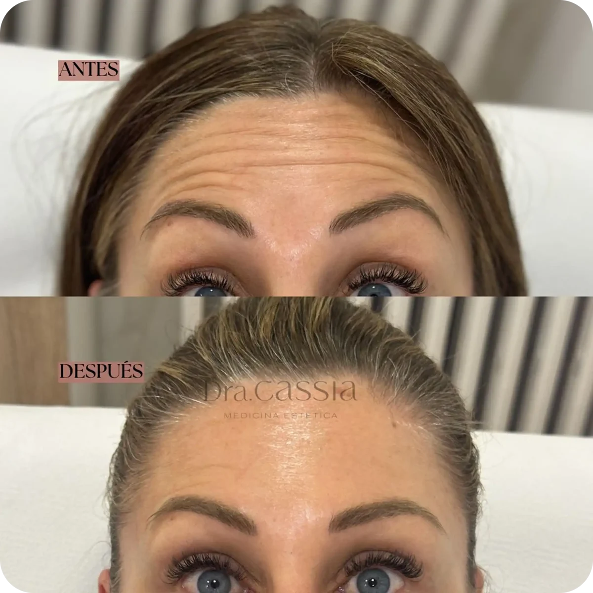 Dra. Cassia Castillo, Medicina Estética, Armonía, Salud, Autentecidad, Madrid, Avenida Felipe, España, Tratamiento Superior, Tratamiento Medio, Tratemiento Inferior, Tratamientos Corporales, Tratamiento Capilar, Tratamiento Corporales, especialista en embellecimiento y rejuvenecimiento facial. Olistic,