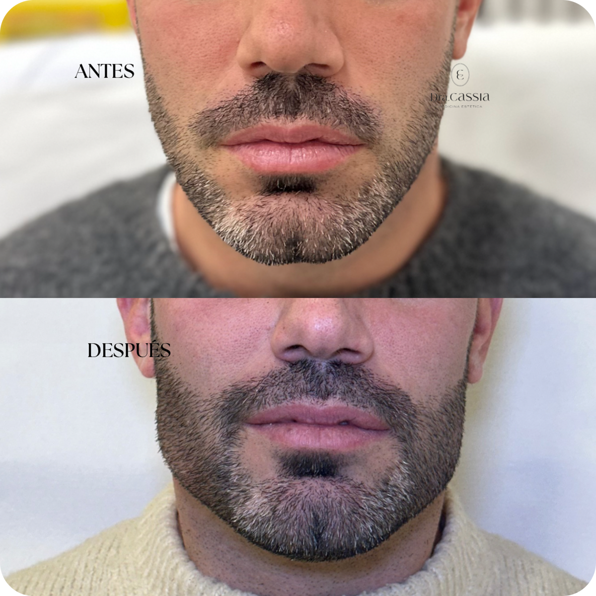 Dra. Cassia Castillo, Medicina Estética, Armonía, Salud, Autentecidad, Madrid, Avenida Felipe, España, Tratamiento Superior, Tratamiento Medio, Tratemiento Inferior, Tratamientos Corporales, Tratamiento Capilar, Tratamiento Corporales, especialista en embellecimiento y rejuvenecimiento facial. Olistic,