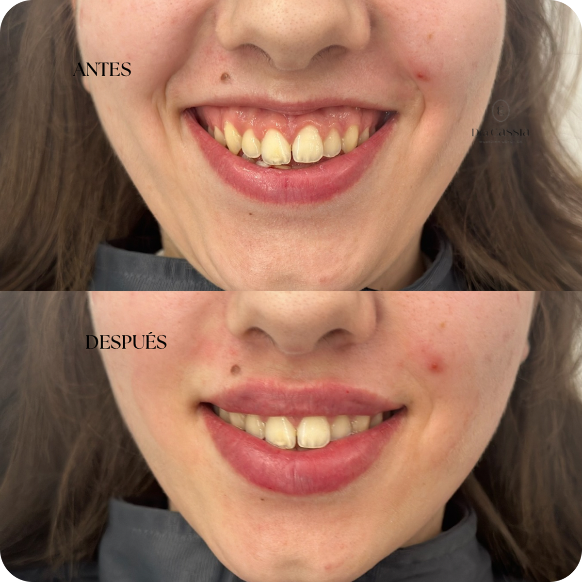 Dra. Cassia Castillo, Medicina Estética, Armonía, Salud, Autentecidad, Madrid, Avenida Felipe, España, Tratamiento Superior, Tratamiento Medio, Tratemiento Inferior, Tratamientos Corporales, Tratamiento Capilar, Tratamiento Corporales, especialista en embellecimiento y rejuvenecimiento facial. Olistic,