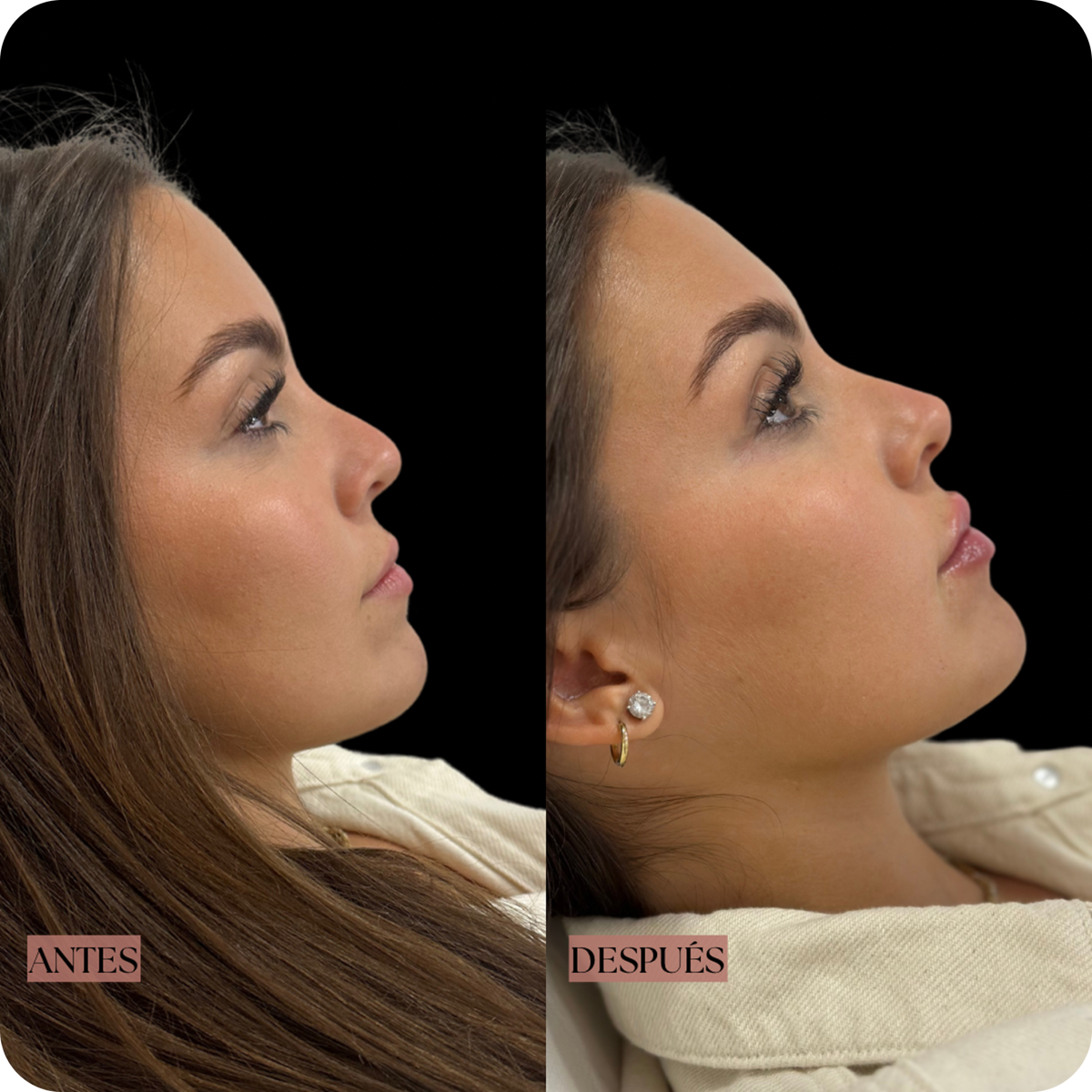 Dra. Cassia Castillo, Medicina Estética, Armonía, Salud, Autentecidad, Madrid, Avenida Felipe, España, Tratamiento Superior, Tratamiento Medio, Tratemiento Inferior, Tratamientos Corporales, Tratamiento Capilar, Tratamiento Corporales, especialista en embellecimiento y rejuvenecimiento facial. Olistic,