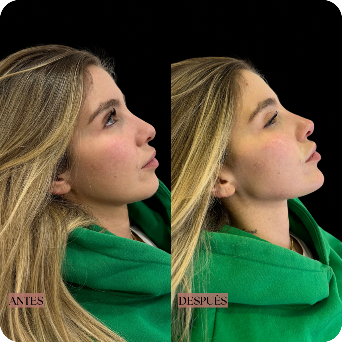 Dra. Cassia Castillo, Medicina Estética, Armonía, Salud, Autentecidad, Madrid, Avenida Felipe, España, Tratamiento Superior, Tratamiento Medio, Tratemiento Inferior, Tratamientos Corporales, Tratamiento Capilar, Tratamiento Corporales, especialista en embellecimiento y rejuvenecimiento facial. Olistic,