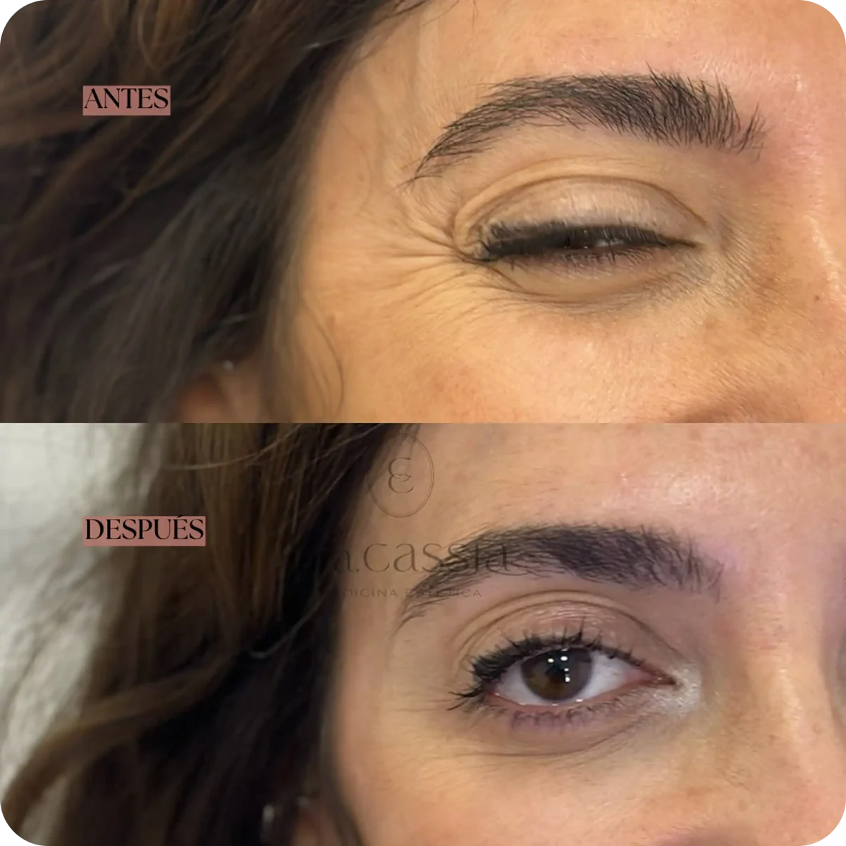 Dra. Cassia Castillo, Medicina Estética, Armonía, Salud, Autentecidad, Madrid, Avenida Felipe, España, Tratamiento Superior, Tratamiento Medio, Tratemiento Inferior, Tratamientos Corporales, Tratamiento Capilar, Tratamiento Corporales, especialista en embellecimiento y rejuvenecimiento facial. Olistic,