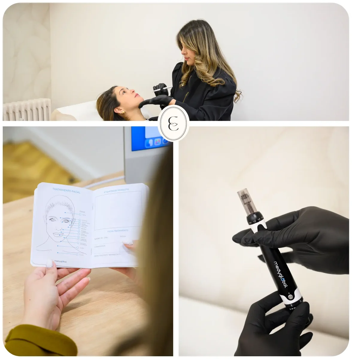 Dra. Cassia Castillo, Medicina Estética, Armonía, Salud, Autentecidad, Madrid, Avenida Felipe, España, Tratamiento Superior, Tratamiento Medio, Tratemiento Inferior, Tratamientos Corporales, Tratamiento Capilar, Tratamiento Corporales, especialista en embellecimiento y rejuvenecimiento facial. Olistic,