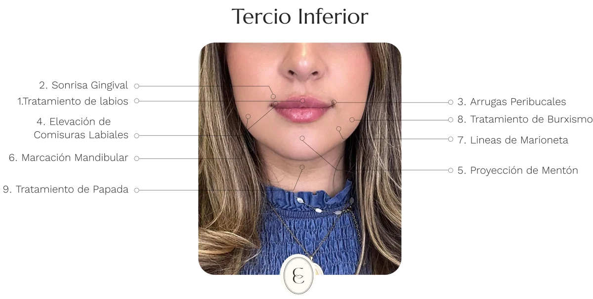 Dra. Cassia Castillo, Medicina Estética, Armonía, Salud, Autentecidad, Madrid, Avenida Felipe, España, Tratamiento Superior, Tratamiento Medio, Tratemiento Inferior, Tratamientos Corporales, Tratamiento Capilar, Tratamiento Corporales, especialista en embellecimiento y rejuvenecimiento facial. Olistic,