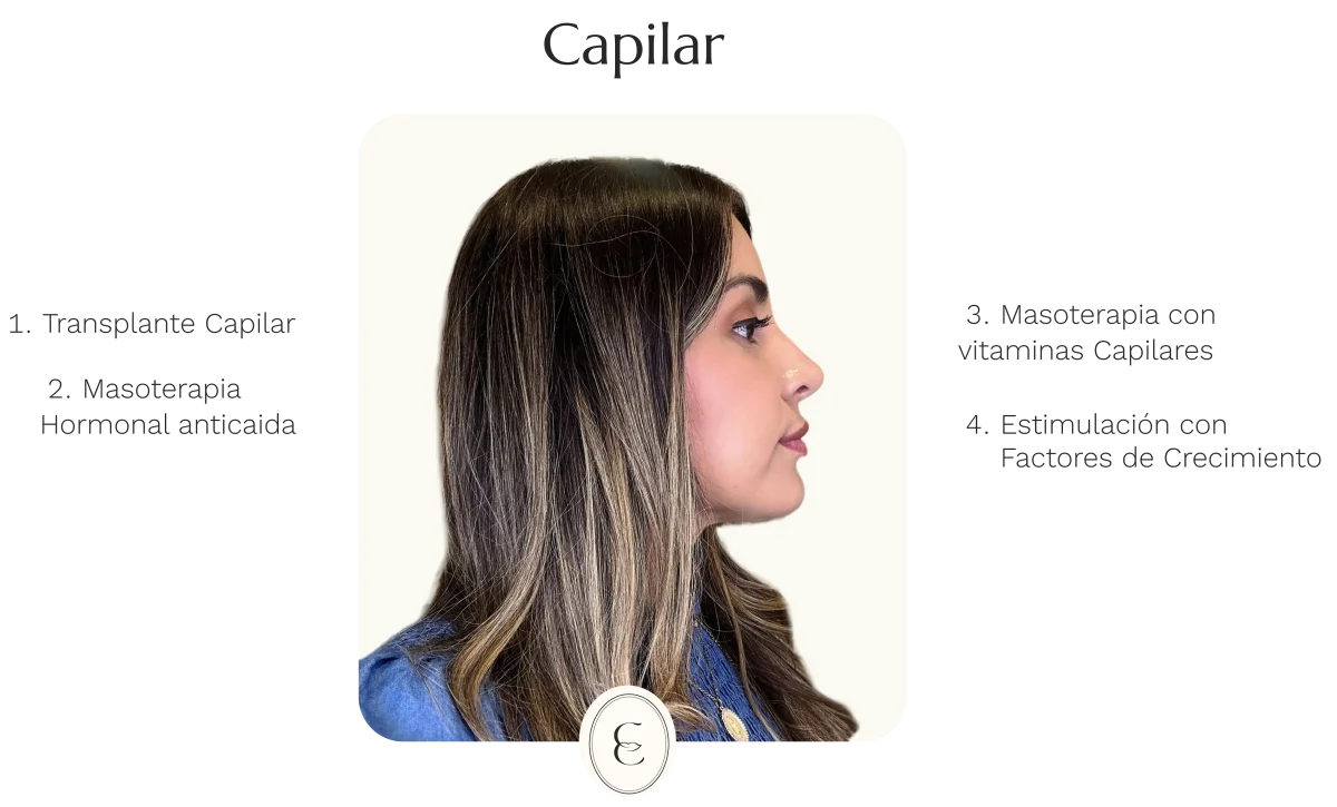 Dra. Cassia Castillo, Medicina Estética, Armonía, Salud, Autentecidad, Madrid, Avenida Felipe, España, Tratamiento Superior, Tratamiento Medio, Tratemiento Inferior, Tratamientos Corporales, Tratamiento Capilar, Tratamiento Corporales, especialista en embellecimiento y rejuvenecimiento facial. Olistic,