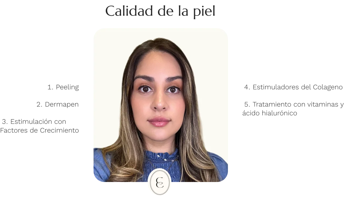 Dra. Cassia Castillo, Medicina Estética, Armonía, Salud, Autentecidad, Madrid, Avenida Felipe, España, Tratamiento Superior, Tratamiento Medio, Tratemiento Inferior, Tratamientos Corporales, Tratamiento Capilar, Tratamiento Corporales, especialista en embellecimiento y rejuvenecimiento facial. Olistic,